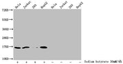 Western Blot Detected samples: Hela whole cell lysate, Jurkat whole cell lysate, 293 whole cell lysate, HepG2 whole cell lysate; Untreated (-) or treated (+) with 30mM sodium butyrate for 4h All lanes: HIST1H3A antibody at 1:2000 Secondary Goat po...