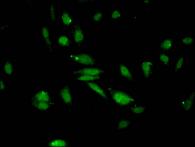 Immunofluorescent analysis of Hela cells using CSB-PA010418OA27me2HU at dilution of 1:100 and Alexa Fluor 488-congugated AffiniPure Goat Anti-Rabbit IgG(H+L)