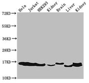 Western Blot Positive WB detected in: Hela cell acid extracts, Jurkat cell acid extracts, HEK293 cell acid extracts, Rat kidney tissue, Mouse brain tissue, Mouse liver tissue, Mouse kidney tissue All lanes: HIST1H3A antibody at 2µg/ml Secondary Go...