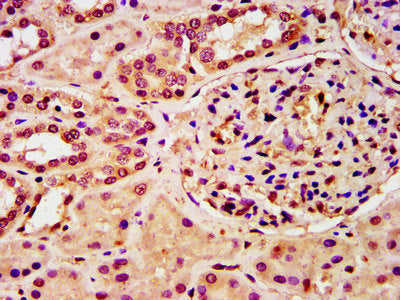 IHC image of CSB-PA010418OA28nphHU diluted at 1:10 and staining in paraffin-embedded human kidney tissue performed on a Leica BondTM system. After dewaxing and hydration, antigen retrieval was mediated by high pressure in a citrate buffer (pH 6.0)...