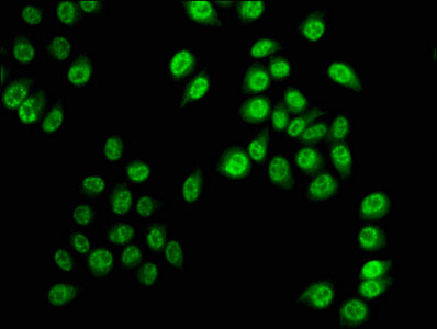 Immunofluorescence staining of Hela cells with CSB-PA010418OA28phHU at 1:5, counter-stained with DAPI. The cells were fixed in 4% formaldehyde, permeabilized using 0.2% Triton X-100 and blocked in 10% normal Goat Serum. The cells were then incubat...
