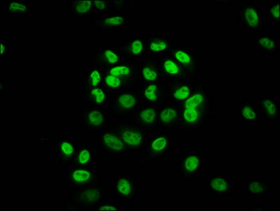 Immunofluorescence staining of Hela cells (treated with 30mM sodium butyrate for 4h) with CSB-PA010418OA36hibHU at 1:20, counter-stained with DAPI. The cells were fixed in 4% formaldehyde, permeabilized using 0.2% Triton X-100 and blocked in 10% n...
