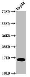 Western Blot Positive WB detected in: HepG2 whole cell lysate All lanes: HIST1H3A antibody at 0.2µg/ml Secondary Goat polyclonal to rabbit IgG at 1/50000 dilution Predicted band size: 16 kDa Observed band size: 16 kDa