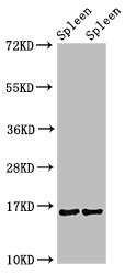 Western Blot Positive WB detected in: Mouse spleen tissue, Rat spleen tissue All lanes: HIST1H3A antibody at 1.4µg/ml Secondary Goat polyclonal to rabbit IgG at 1/50000 dilution Predicted band size: 16 kDa Observed band size: 16 kDa