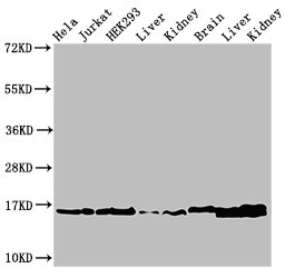 Western Blot Positive WB detected in: Hela cell acid extracts, Jurkat cell acid extracts, HEK293 cell acid extracts, Rat liver tissue, Rat kidney tissue, Mouse brain tissue, Mouse liver tissue, Mouse kidney tissue All lanes: HIST1H3A antibody at 1...
