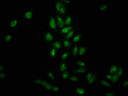 Immunofluorescence staining of Hela cells with CSB-PA010418OA41phHU at 1:25, counter-stained with DAPI. The cells were fixed in 4% formaldehyde, permeabilized using 0.2% Triton X-100 and blocked in 10% normal Goat Serum. The cells were then incuba...