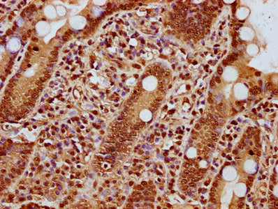 IHC image of CSB-PA010418OA42nme2HU diluted at 1:25 and staining in paraffin-embedded human small intestine tissue performed on a Leica BondTM system. After dewaxing and hydration, antigen retrieval was mediated by high pressure in a citrate buffe...