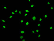 Immunofluorescence staining of Hela cells (treated with 50mM sodium 3-hydroxybutyrate for 72h) with CSB-PA010418OA56bhbHU at 1:15, counter-stained with DAPI. The cells were fixed in 4% formaldehyde, permeabilized using 0.2% Triton X-100 and blocke...