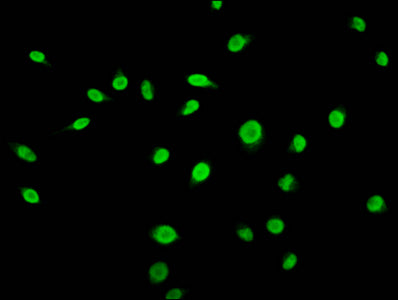 Immunofluorescence staining of Hela cells (treated with 50mM sodium 3-hydroxybutyrate for 72h) with CSB-PA010418OA56bhbHU at 1:15, counter-stained with DAPI. The cells were fixed in 4% formaldehyde, permeabilized using 0.2% Triton X-100 and blocke...
