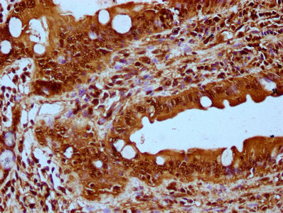 IHC image of CSB-PA010418OA56nbhbHU diluted at 1:20 and staining in paraffin-embedded human small intestine tissue performed on a Leica BondTM system. After dewaxing and hydration, antigen retrieval was mediated by high pressure in a citrate buffe...