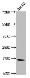Western Blot Positive WB detected in: HepG2 whole cell lysate All lanes: HIST1H3A antibody at 1.39µg/ml Secondary Goat polyclonal to rabbit IgG at 1/50000 dilution Predicted band size: 16 kDa Observed band size: 16 kDa