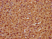 IHC image of CSB-PA010418OA63nme1HU diluted at 1:25 and staining in paraffin-embedded human adrenal gland tissue performed on a Leica BondTM system. After dewaxing and hydration, antigen retrieval was mediated by high pressure in a citrate buffer...