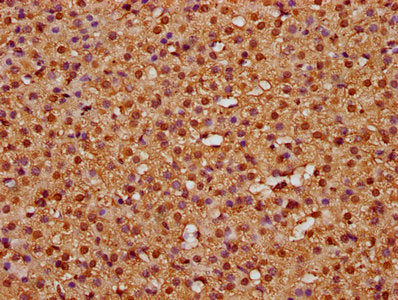 IHC image of CSB-PA010418OA63nme1HU diluted at 1:25 and staining in paraffin-embedded human adrenal gland tissue performed on a Leica BondTM system. After dewaxing and hydration, antigen retrieval was mediated by high pressure in a citrate buffer...