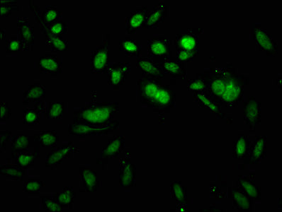 Immunofluorescence staining of Hela cells with CSB-PA010418OA64acHU at 1:5, counter-stained with DAPI. The cells were fixed in 4% formaldehyde, permeabilized using 0.2% Triton X-100 and blocked in 10% normal Goat Serum. The cells were then incubat...