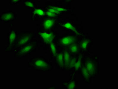 Immunofluorescence staining of Hela cells with CSB-PA010418OA64nme1HU at 1:7.5, counter-stained with DAPI. The cells were fixed in 4% formaldehyde, permeabilized using 0.2% Triton X-100 and blocked in 10% normal Goat Serum. The cells were then inc...