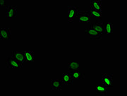 Immunofluorescence staining of Hela cells with CSB-PA010418OA79acHU at 1:7.5, counter-stained with DAPI. The cells were fixed in 4% formaldehyde, permeabilized using 0.2% Triton X-100 and blocked in 10% normal Goat Serum. The cells were then incub...