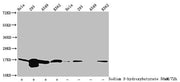 Western Blot Detected samples: Hela whole cell lysate, 293 whole cell lysate, A549 whole cell lysate, K562 whole cell lysate; Untreated (-) or treated (+) with 50mM sodium 3-hydroxybutyrate for 72h All lanes: HIST1H3A antibody at 1:100 Secondary G...