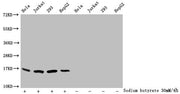 Western Blot Detected samples: Hela whole cell lysate, Jurkat whole cell lysate, 293 whole cell lysate, HepG2 whole cell lysate; Untreated (-) or treated (+) with 30mM sodium butyrate for 4h All lanes: HIST1H3A antibody at 1:1000 Secondary Goat po...
