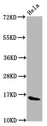 Western Blot Positive WB detected in: Hela whole cell lysate All lanes: HIST1H3A antibody at 0.61µg/ml Secondary Goat polyclonal to rabbit IgG at 1/50000 dilution Predicted band size: 16 kDa Observed band size: 16 kDa