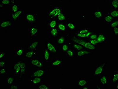 Immunofluorescence staining of Hela cells with CSB-PA010418OA80phHU at 1:10, counter-stained with DAPI. The cells were fixed in 4% formaldehyde, permeabilized using 0.2% Triton X-100 and blocked in 10% normal Goat Serum. The cells were then incuba...