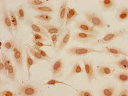 Immunocytochemistry analysis of Hela cells using CSB-PA010418PA04me2HU at dilution of 1:100