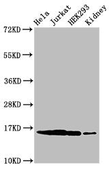 Western Blot Positive WB detected in: Hela cell acid extracts, Jurkat cell acid extracts, HEK293 cell acid extracts, Mouse kidney tissue All lanes: HIST1H3A antibody at 0.4µg/ml Secondary Goat polyclonal to rabbit IgG at 1/50000 dilution Predicted...