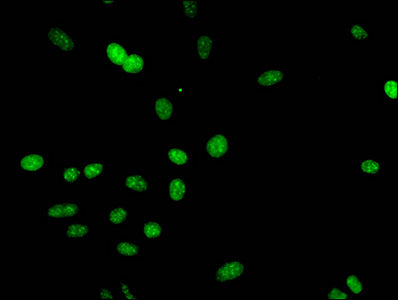 Immunofluorescent analysis of Hela cells using CSB-PA010418PA09me3HU at dilution of 1:100 and Alexa Fluor 488-congugated AffiniPure Goat Anti-Rabbit IgG(H+L)