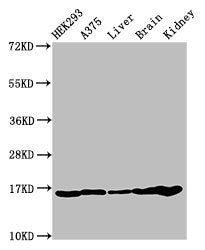 Western Blot Positive WB detected in: HEK293 cell acid extracts, A375 cell acid extracts, Mouse liver tissue, Mouse brain tissue, Mouse kidney tissue All lanes: HIST1H3A antibody at 1µg/ml Secondary Goat polyclonal to rabbit IgG at 1/50000 dilutio...