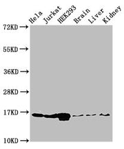 Western Blot Positive WB detected in: Hela cell acid extracts, Jurkat cell acid extracts, HEK293 cell acid extracts, Mouse brain tissue, Mouse liver tissue, Mouse kidney tissue All lanes: HIST1H3A antibody at 1µg/ml Secondary Goat polyclonal to ra...
