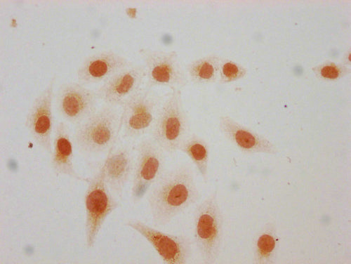 Immunocytochemistry analysis of CSB-PA010418PA115acHU diluted at 1:20 and staining in Hela cells(treated with 30mM sodium butyrate for 4h) performed on a Leica BondTM system. The cells were fixed in 4% formaldehyde, permeabilized using 0.2% Triton...