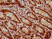 IHC image of CSB-PA010418PA122nsucHU diluted at 1:20 and staining in paraffin-embedded human small intestine tissue performed on a Leica BondTM system. After dewaxing and hydration, antigen retrieval was mediated by high pressure in a citrate buff...