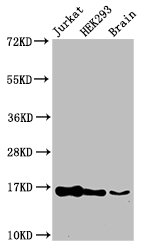 Western Blot Positive WB detected in: Jurkat cell acid extracts, HEK293 cell acid extracts, Mouse brain tissue All lanes: HIST1H3A antibody at 1µg/ml Secondary Goat polyclonal to rabbit IgG at 1/50000 dilution Predicted band size: 16 kDa Observed...