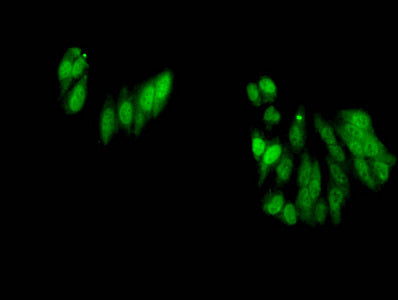 Immunofluorescent analysis of Hela cells using CSB-PA010418PA17me2HU at dilution of 1:100 and Alexa Fluor 488-congugated AffiniPure Goat Anti-Rabbit IgG(H+L)