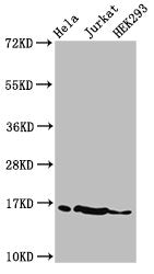 Western Blot Positive WB detected in: Hela cell acid extracts, Jurkat cell acid extracts, HEK293 cell acid extracts All lanes: HIST1H3A antibody at 2µg/ml Secondary Goat polyclonal to rabbit IgG at 1/50000 dilution Predicted band size: 16 kDa Obse...