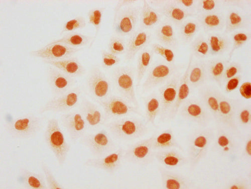 Immunocytochemistry analysis of CSB-PA010418PA18forHU diluted at 1:20 and staining in Hela cells(treated with 30mM sodium butyrate for 4h) performed on a Leica BondTM system. The cells were fixed in 4% formaldehyde, permeabilized using 0.2% Triton...
