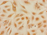Immunocytochemistry analysis of Hela cells using CSB-PA010418PA27me1HU at dilution of 1:100