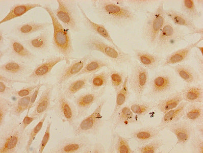 Immunocytochemistry analysis of Hela cells using CSB-PA010418PA27me1HU at dilution of 1:100