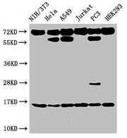 Western Blot Positive WB detected in: NIH/3T3 cell acid extracts, Hela cell acid extracts, A549 cell acid extracts, Jurkat cell acid extracts, PC-3 cell acid extracts, HEK293 cell acid extracts All lanes: HIST1H3A antibody at 2µg/ml Secondary Goat...