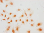 Immunocytochemistry analysis of CSB-PA010418PA36hibHU diluted at 1:15 and staining in Hela cells(treated with 30mM sodium butyrate for 4h) performed on a Leica BondTM system. The cells were fixed in 4% formaldehyde, permeabilized using 0.2% Triton...