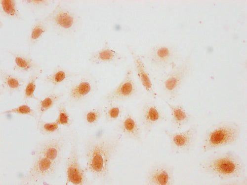 Immunocytochemistry analysis of CSB-PA010418PA36hibHU diluted at 1:15 and staining in Hela cells(treated with 30mM sodium butyrate for 4h) performed on a Leica BondTM system. The cells were fixed in 4% formaldehyde, permeabilized using 0.2% Triton...