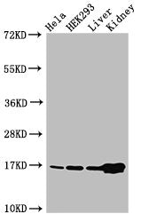 Western Blot Positive WB detected in: Hela cell acid extracts, HEK293 cell acid extracts, Mouse liver tissue, Mouse kidney tissue All lanes: HIST1H3A antibody at 2µg/ml Secondary Goat polyclonal to rabbit IgG at 1/50000 dilution Predicted band siz...