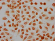 Immunocytochemistry analysis of CSB-PA010418PA41phHU diluted at 1:20 and staining in Hela cells(treated with 50nM Calyculin A for 30min) performed on a Leica BondTM system. The cells were fixed in 4% formaldehyde, permeabilized using 0.2% Triton X...