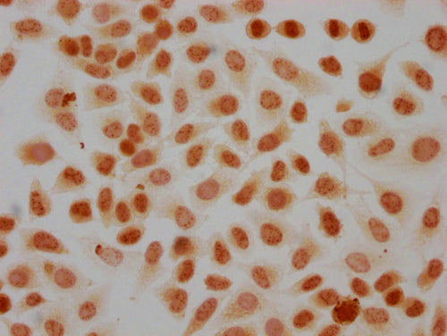 Immunocytochemistry analysis of CSB-PA010418PA41phHU diluted at 1:20 and staining in Hela cells(treated with 50nM Calyculin A for 30min) performed on a Leica BondTM system. The cells were fixed in 4% formaldehyde, permeabilized using 0.2% Triton X...