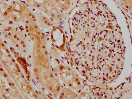 IHC image of CSB-PA010418PA45nphHU diluted at 1:30 and staining in paraffin-embedded human kidney tissue performed on a Leica BondTM system. After dewaxing and hydration, antigen retrieval was mediated by high pressure in a citrate buffer (pH 6.0)...