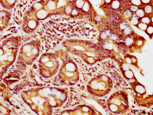 IHC image of CSB-PA010418PA56nsucHU diluted at 1:20 and staining in paraffin-embedded human small intestine tissue performed on a Leica BondTM system. After dewaxing and hydration, antigen retrieval was mediated by high pressure in a citrate buffe...