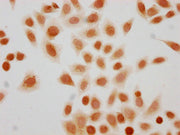 Immunocytochemistry analysis of CSB-PA010418PA56sucHU diluted at 1:10 and staining in Hela cells(treated with 10mM disodium succinylate for 4h) performed on a Leica BondTM system. The cells were fixed in 4% formaldehyde, permeabilized using 0.2% T...