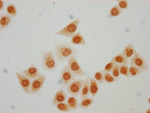 Immunocytochemistry analysis of CSB-PA010418PA64acHU diluted at 1:10 and staining in Hela cells(treated with 30mM sodium butyrate for 4h) performed on a Leica BondTM system. The cells were fixed in 4% formaldehyde, permeabilized using 0.2% Triton...