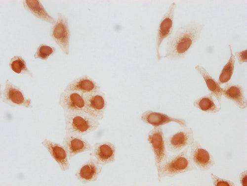 Immunocytochemistry analysis of CSB-PA010418PA79forHU diluted at 1:20 and staining in Hela cells(treated with 30mM sodium butyrate for 4h) performed on a Leica BondTM system. The cells were fixed in 4% formaldehyde, permeabilized using 0.2% Triton...
