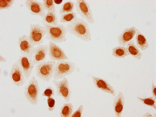 Immunocytochemistry analysis of CSB-PA010418PA79hibHU diluted at 1:10 and staining in Hela cells(treated with 30mM sodium butyrate for 4h) performed on a Leica BondTM system. The cells were fixed in 4% formaldehyde, permeabilized using 0.2% Triton...