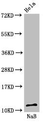Western Blot Positive WB detected in: Hela cell acid extracts treated by 15mM NaB for 60min All lanes: HIST1H4A antibody at 1.6µg/ml Secondary Goat polyclonal to rabbit IgG at 1/50000 dilution Predicted band size: 12 kDa Observed band size: 12 kDa